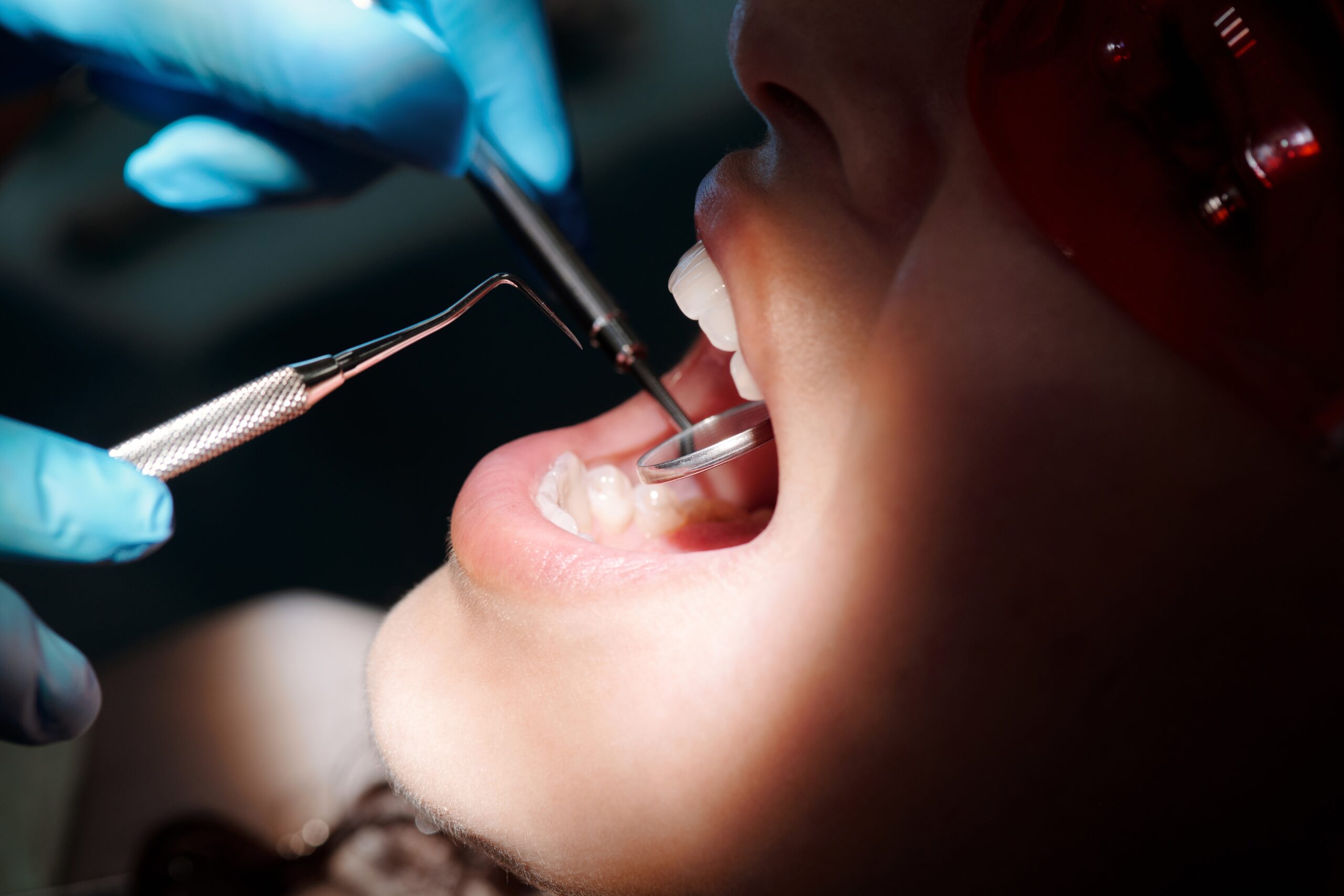 Researchers Create New Treatment for Stopping Tooth Decay: Will It Work?