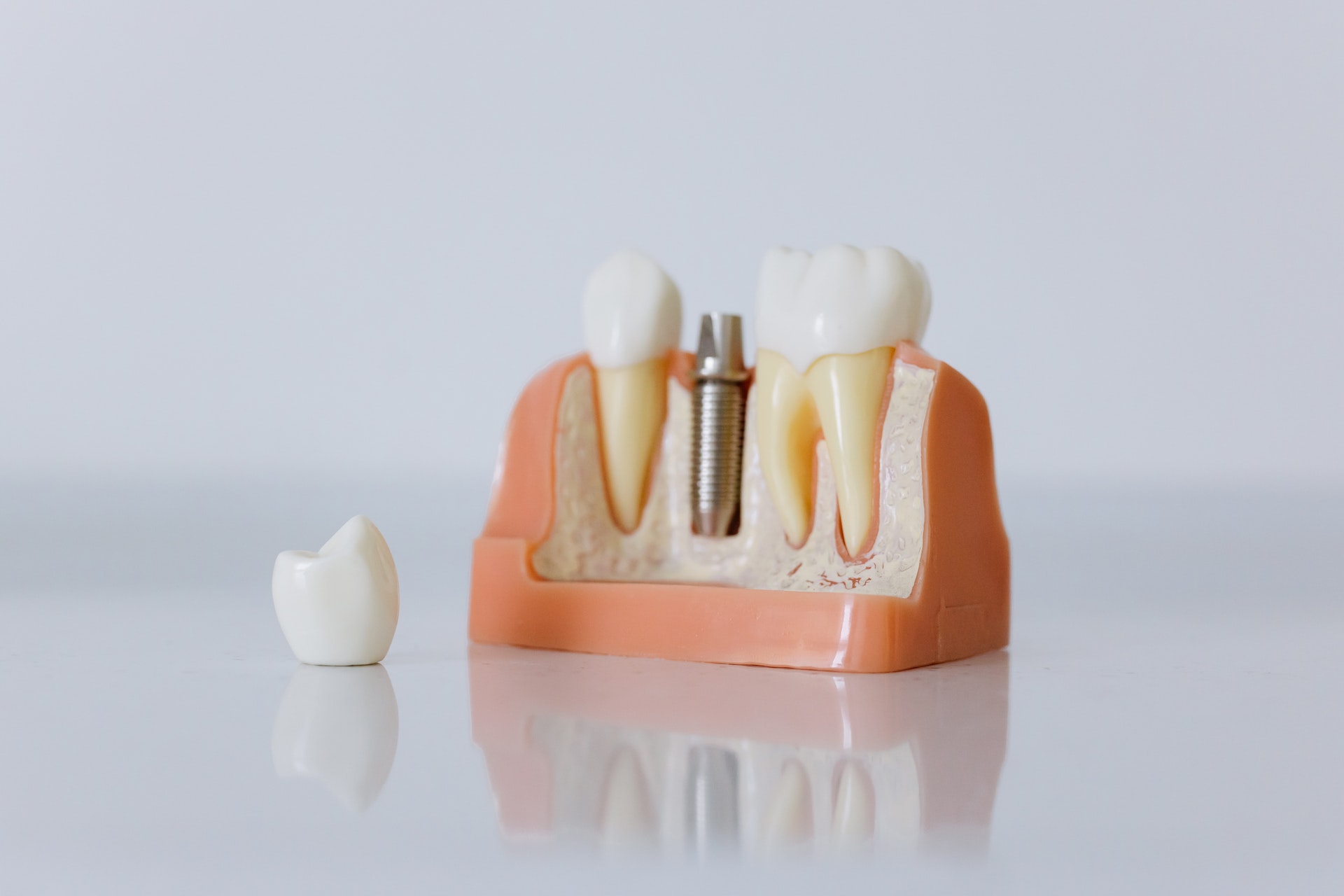 Could Artificial Intelligence Help Develop New Dental Crowns?