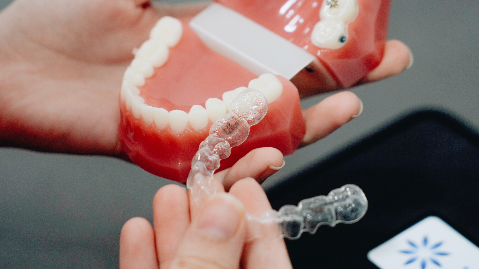 The Rise of Digital Orthdontics: How Could Dental Retainers Be Improved?