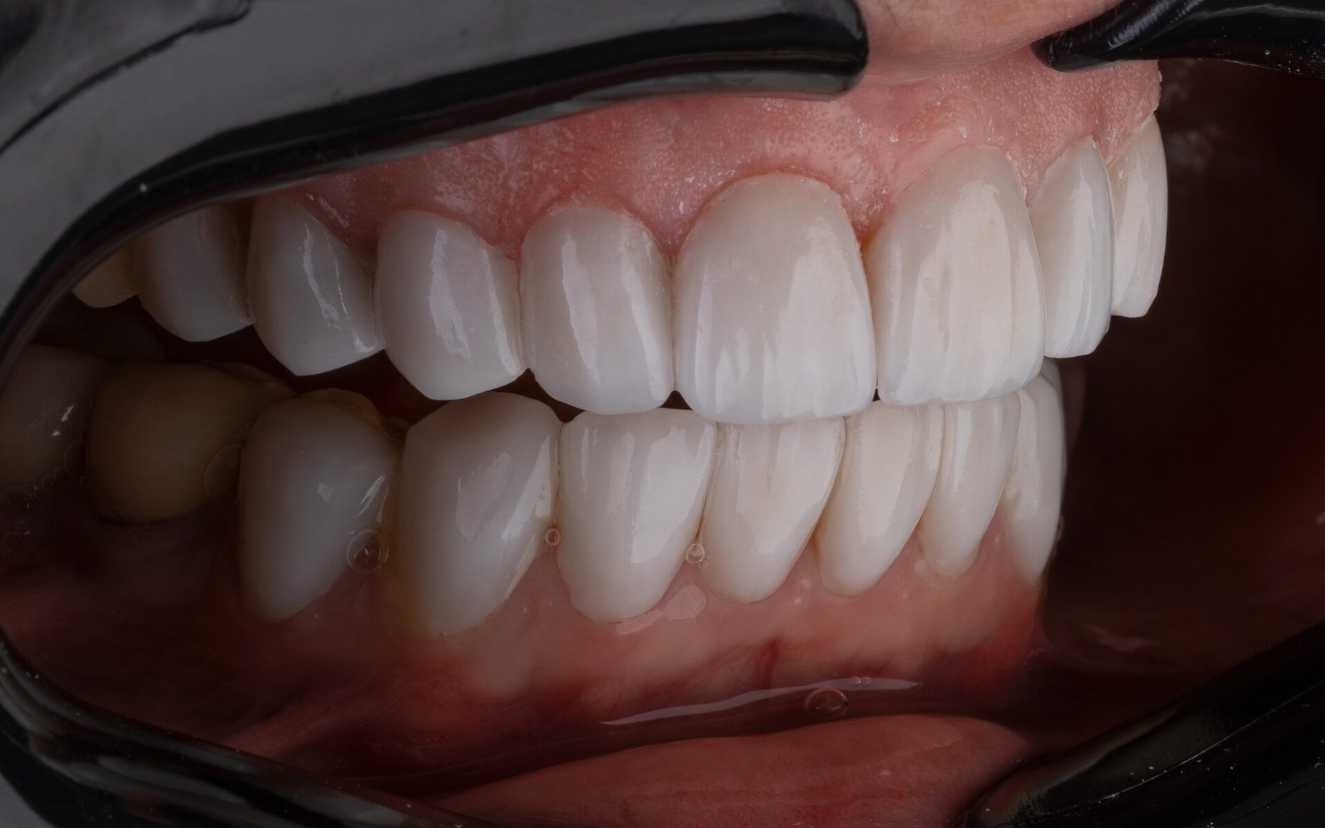 How Do Your Teeth Age, and How Can You Extend the Life of Your Smile?