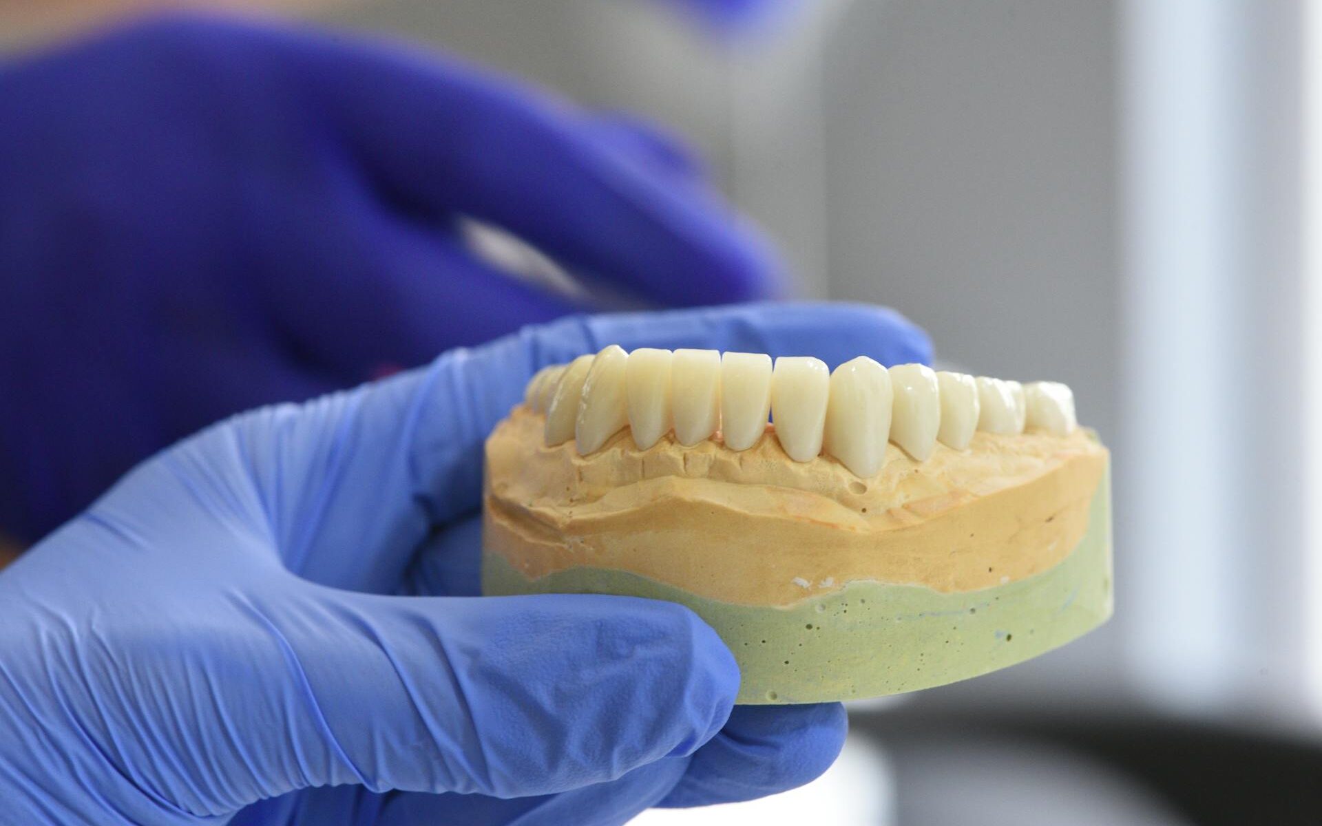 How Can a New Eco-Friendly Coating Positively Impact Titanium Dental Implants?