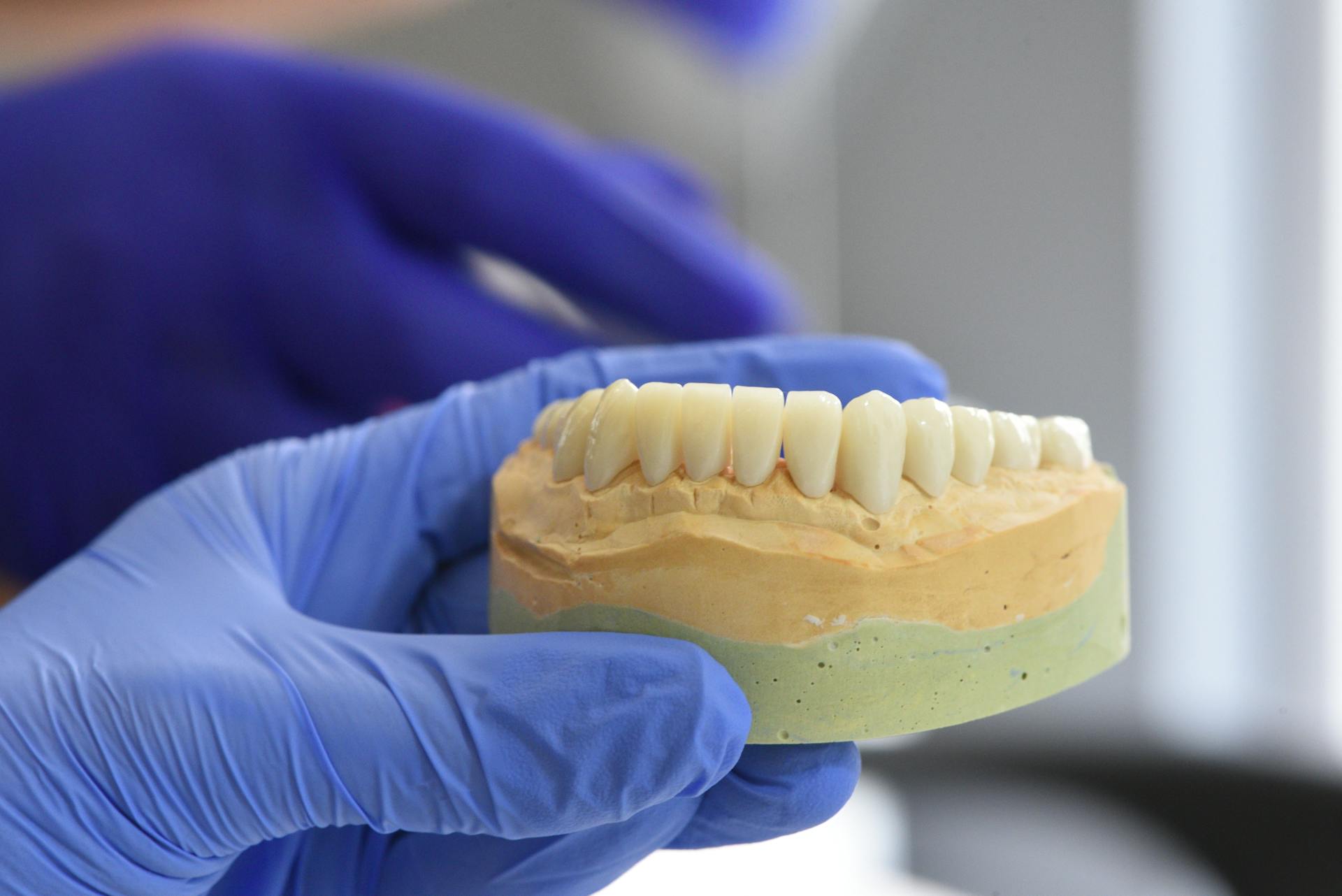 How Can a New Eco-Friendly Coating Positively Impact Titanium Dental Implants?