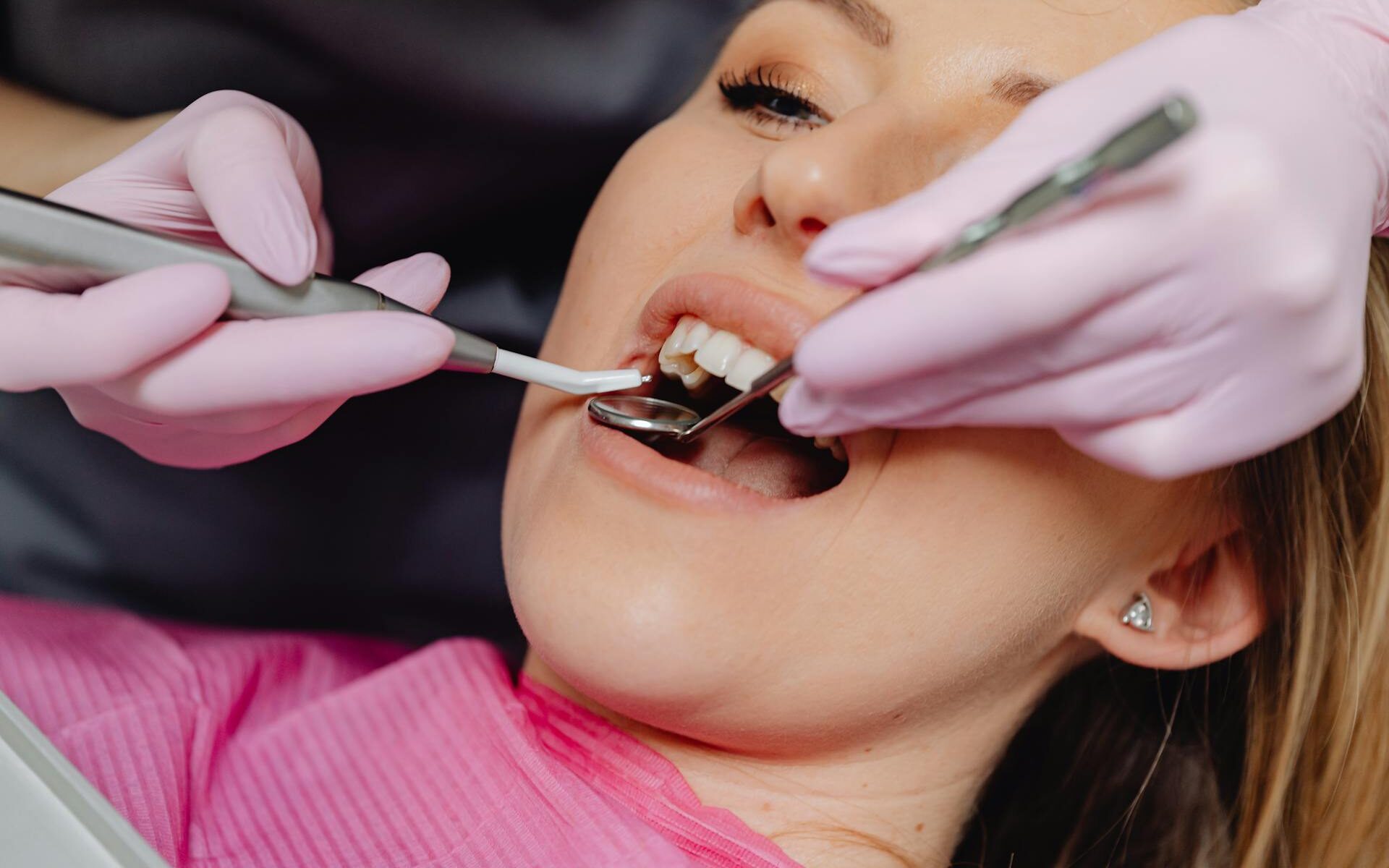 How Many Young Adults in the USA Have Skipped the Dentist in the Last 12 Months?